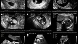 Abort: Nemder vil kunne bli en støtte for kvinnen